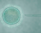 Inseminación Intrauterina (IIU)-image